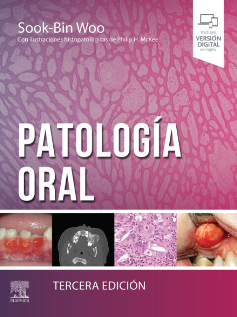 Cover image for book Patología oral
