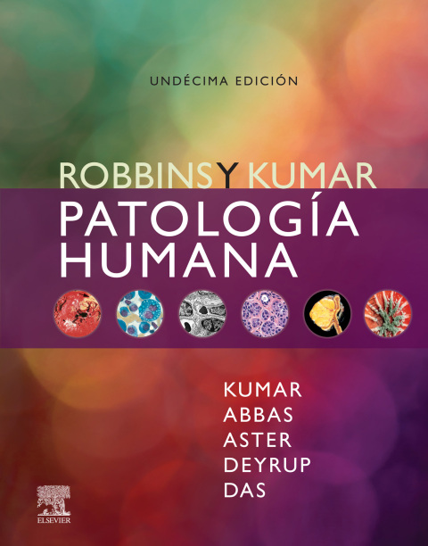 Robbins y Kumar. PatologÃ­a humana 