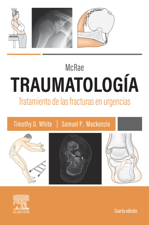 Cover image for book McRae. Traumatología. Tratamiento de las fracturas en urgencias