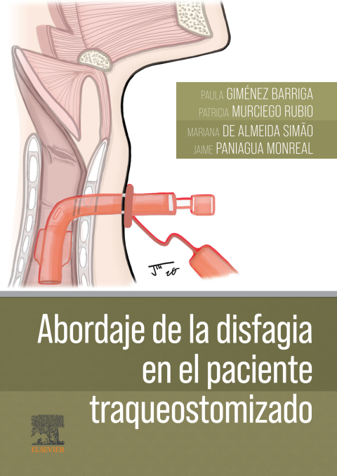 Cover image for book Abordaje de la disfagia en el paciente traqueostomizado