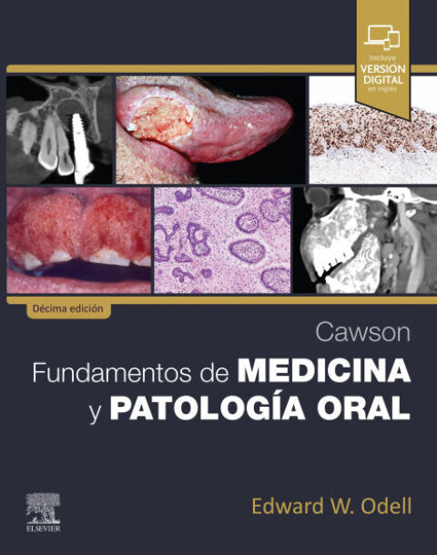 Cover image for book Cawson. Fundamentos de medicina y patología oral