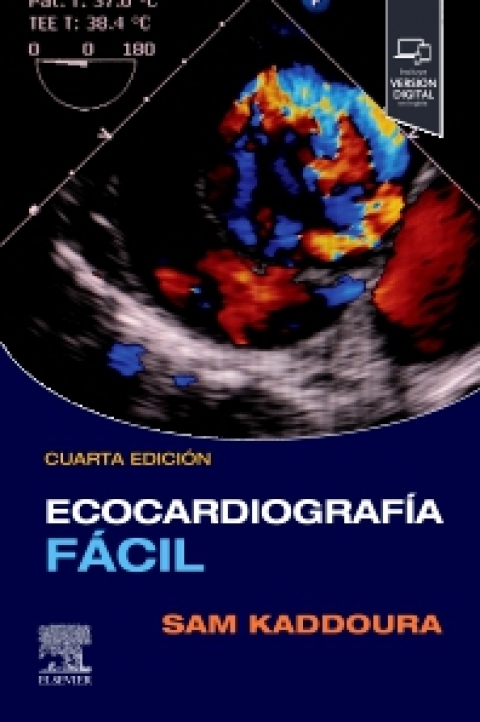 Cover image for book Ecocardiografía fácil