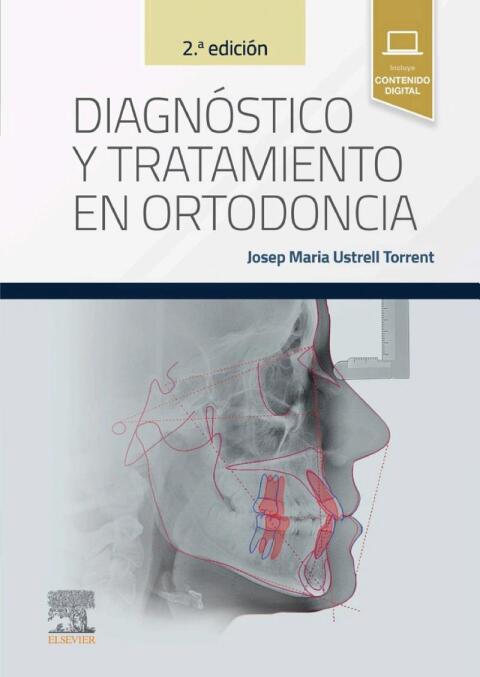 Cover image for book Diagnóstico y tratamiento en ortodoncia