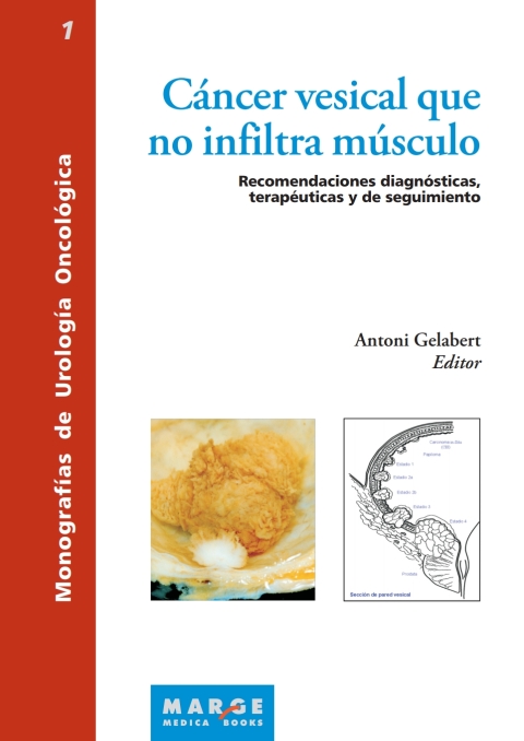 Cover image for book Cáncer vesical que no infiltra músculo