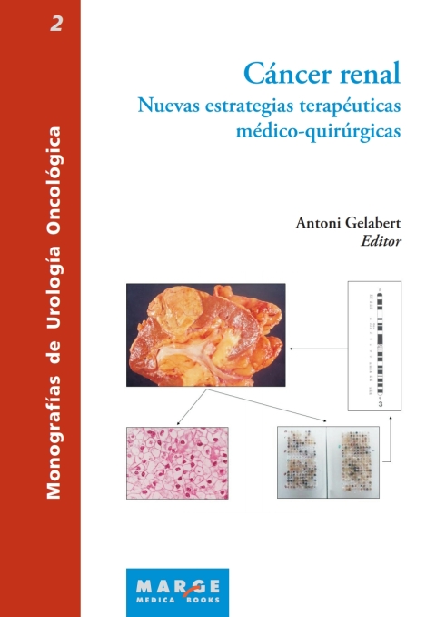 Cover image for book Cáncer renal. Nuevas estrategias terapeuticas medico-quirurgicas