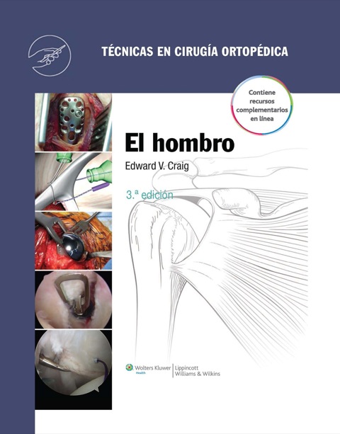 Cover image for book Técnicas en cirugía ortopédica. El Hombro