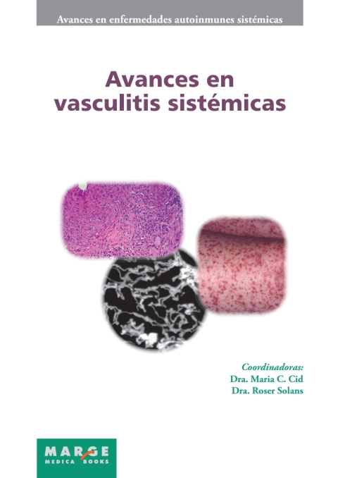 Cover image for book Avances en vasculitis sistémicas