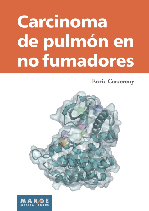 Carcinoma de pulmón en no fumadores 
