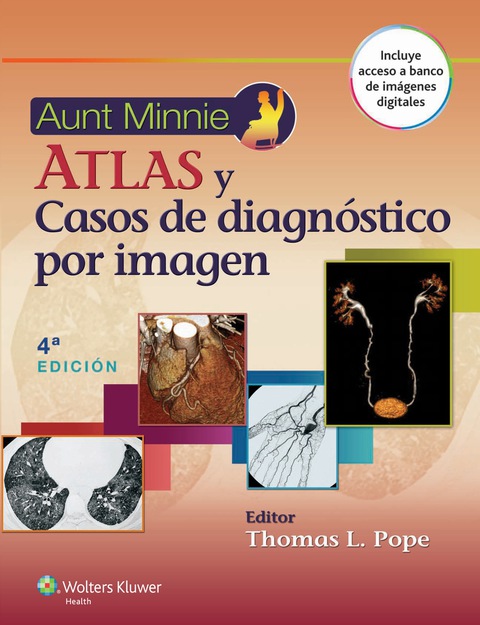 Aunt Minnie's. Atlas y casos de diagnóstico por imagen