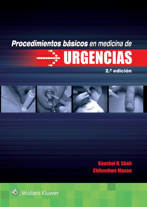 Procedimientos básicos en medicina de urgencias