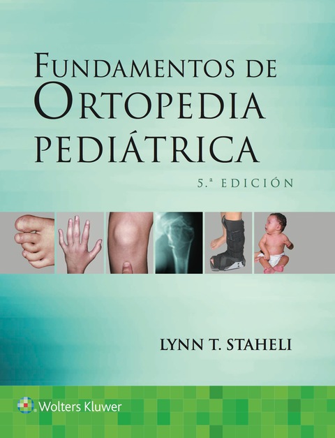 Fundamentos de ortopedia pediátrica