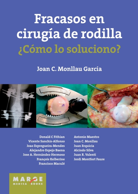 Cover image for book Fracasos en cirugía de rodilla