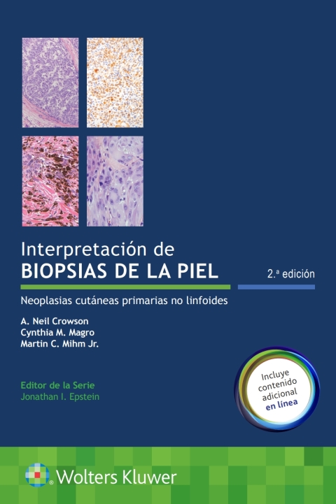 Interpretación de biopsias de la piel