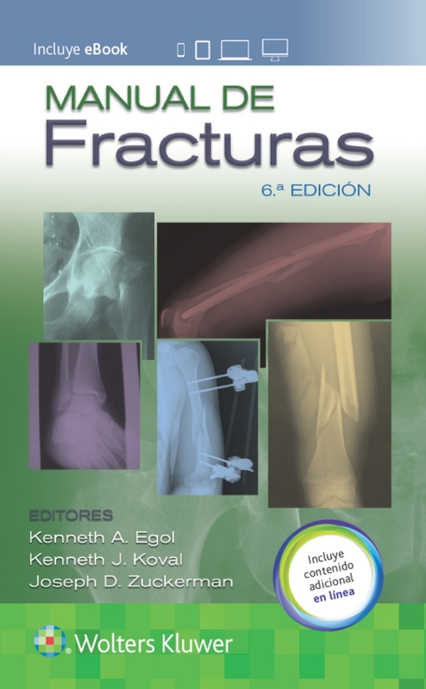 Manual de fracturas