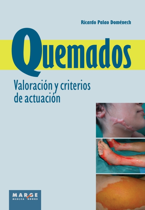 Cover image for book Quemados. Valoración y criterios de actuación