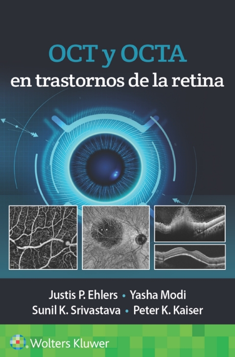 OCT y OCTA en trastornos de la retina