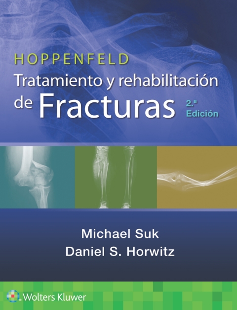 Hoppenfeld. Tratamiento y rehabilitación de fracturas