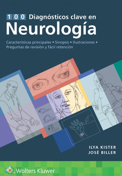 100 diagnósticos clave en neurología