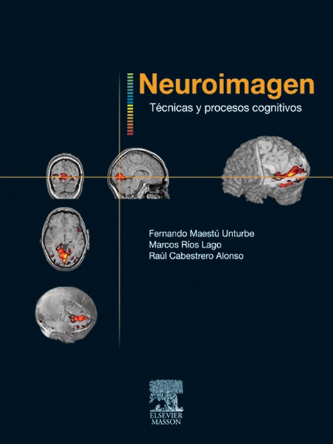 Neuroimagen. TÃ©cnicas y procesos cognitivos 