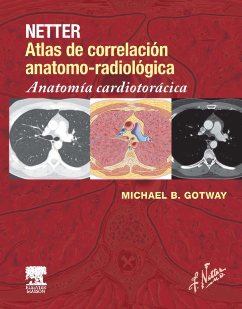 Cover image for book Netter. Atlas de correlación anatomo-radiológica: Anatomía cardiotorácica