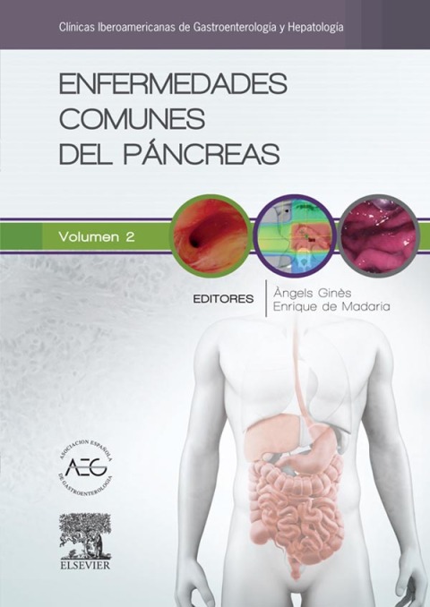 Cover image for book Enfermedades comunes del páncreas