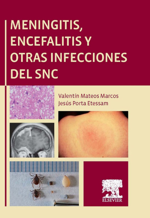 Cover image for book Meningitis, encefalitis y otras infecciones del SNC