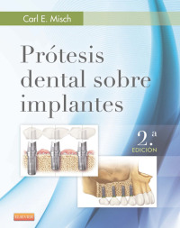 صورة الغلاف: Prótesis dental sobre implantes 2nd edition 9788490228630
