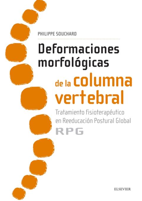 Deformaciones morfológicas de la columna vertebral