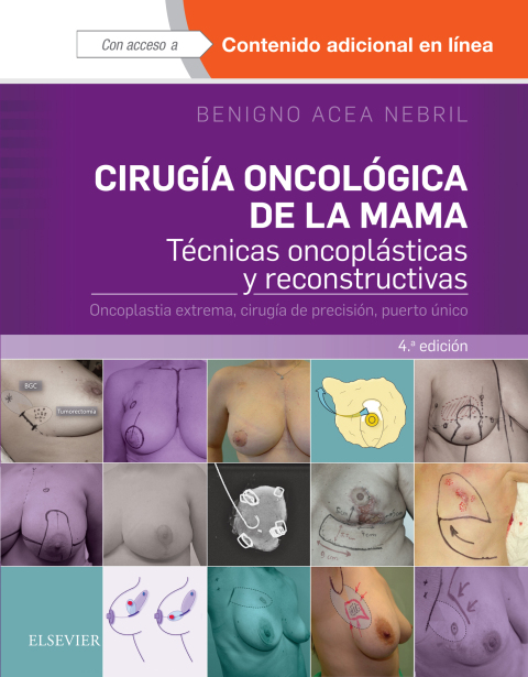 Cover image for book Cirugía oncológica de la mama