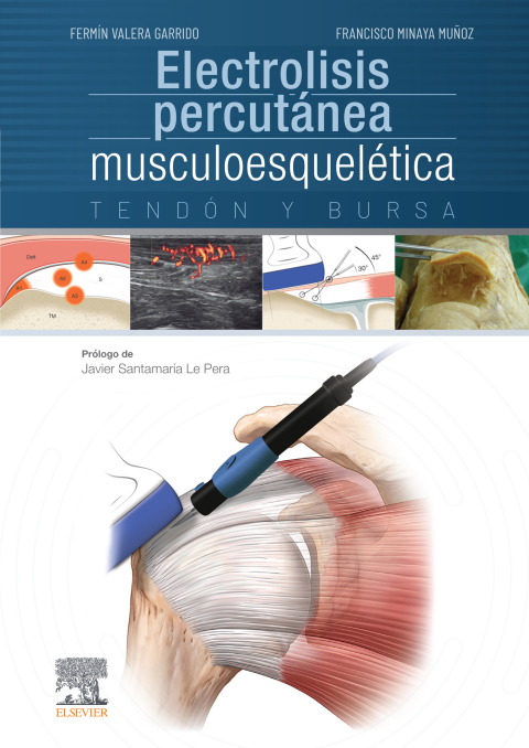 Cover image for book Electrolisis percutánea musculoesquelética