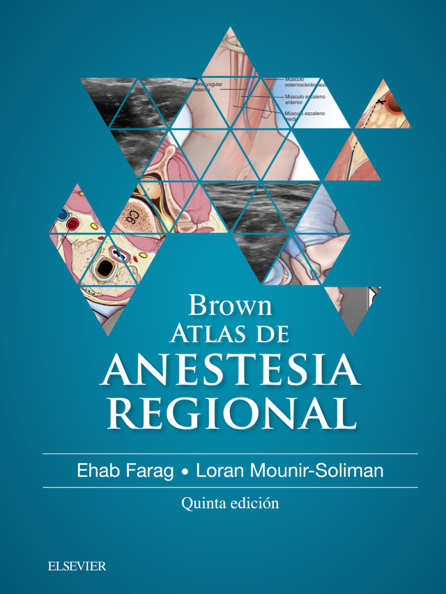 Brown. Atlas de Anestesia Regional