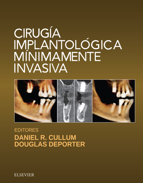 Cover image for book Cirugía implantológica mínimamente invasiva
