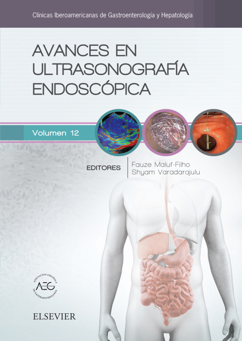Cover image for book Avances en ultrasonografía endoscópica