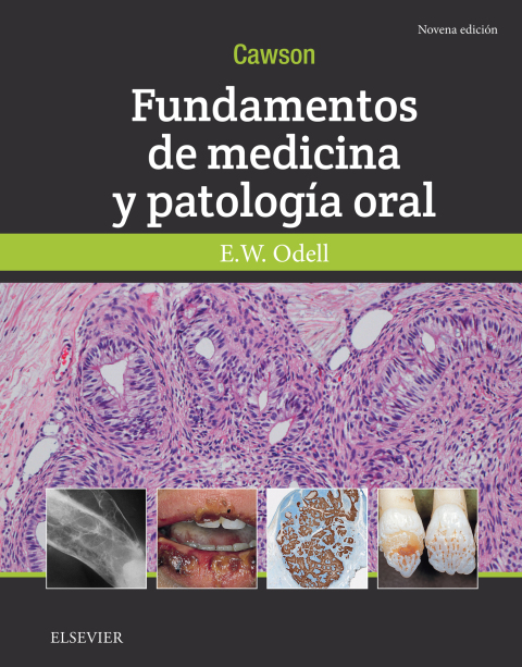 Cover image for book Cawson.Fundamentos de medicina y patología oral