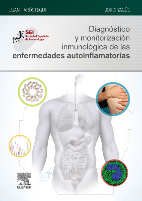 Cover image for book Diagnóstico y monitorización inmunológica de las enfermedades autoinflamatorias