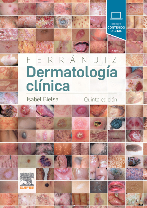 Cover image for book Ferrándiz. Dermatología clínica