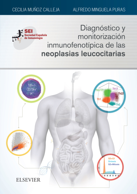 Cover image for book Diagnóstico y monitorización inmunofenotípica de las neoplasias leucocitarias