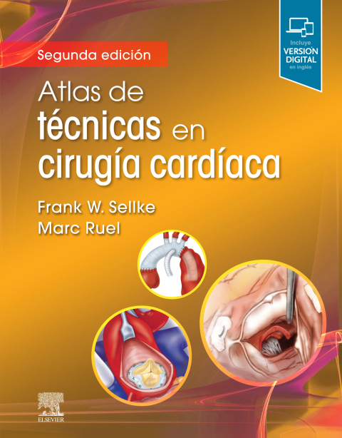 Cover image for book Atlas de técnicas en cirugía cardíaca