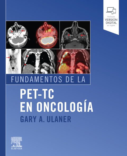 Cover image for book Fundamentos de la PET-TC en oncología
