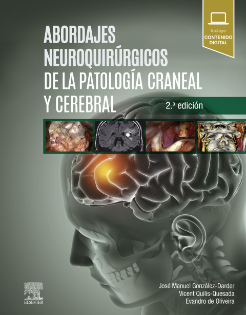 Cover image for book Abordajes neuroquirúrgicos de la patología craneal y cerebral
