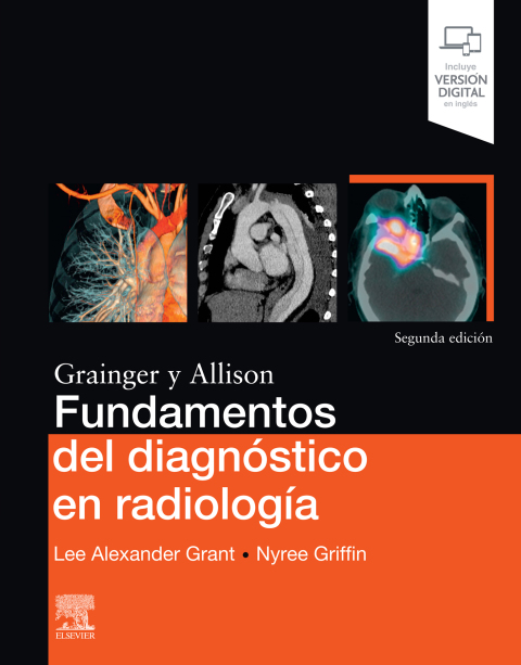 Cover image for book Fundamentos del diagnóstico en radiología