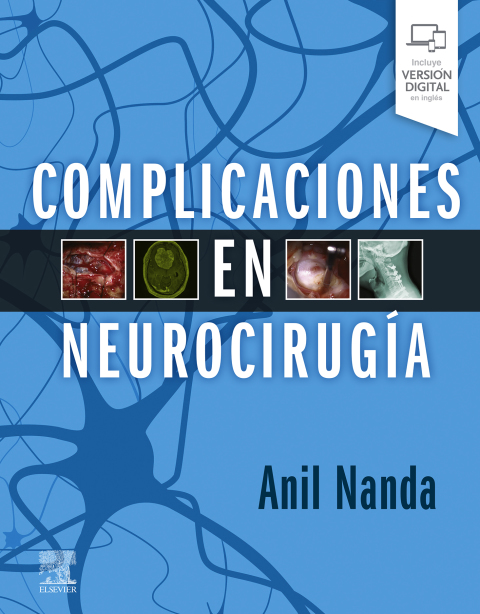 Complicaciones en neurocirugÃ­a 