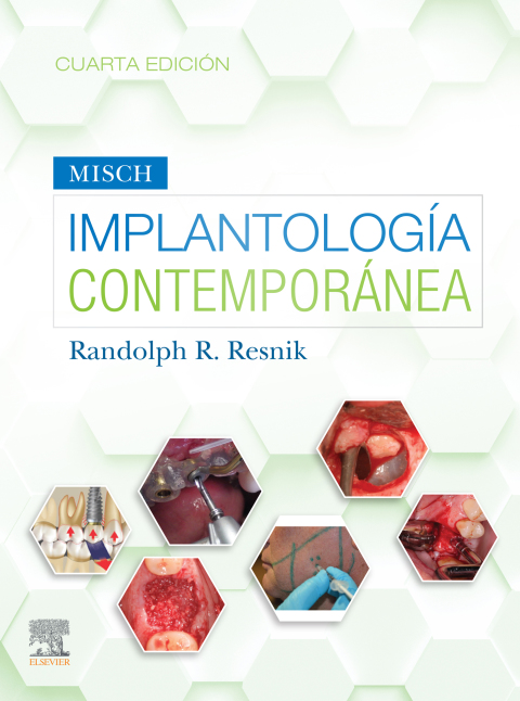 Cover image for book Misch. Implantología contemporánea