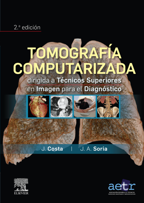 Cover image for book Tomografía computarizada dirigida a técnicos superiores en imagen para el diagnóstico