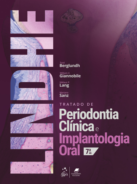 Lindhe tratado de periodontia clinica e implantologia oral