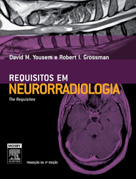 Cover image for book Neuroradiologia