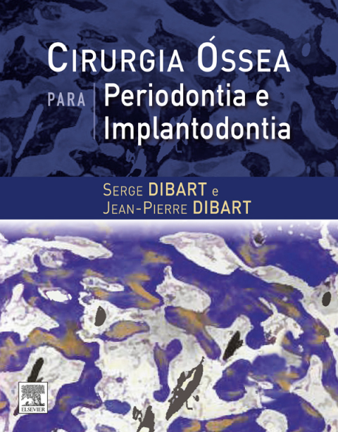 Cover image for book Cirurgia Óssea para Periodontia e Implantodontia