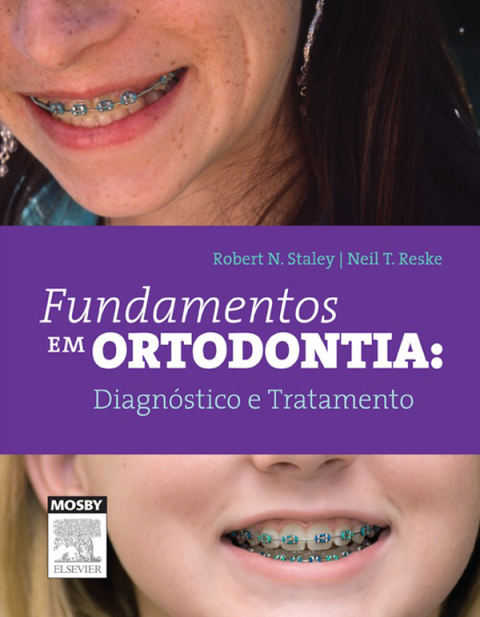 Cover image for book Fundamentos em Ortodontia: Diagnóstico e Tratamento
