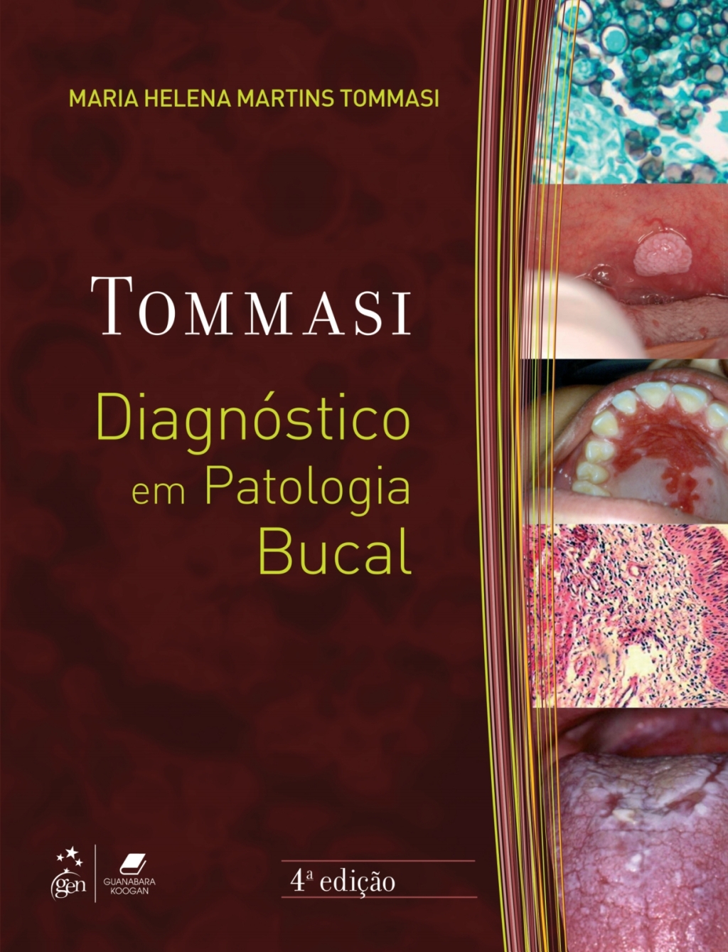 DiagnÃ³stico em Patologia Bucal - 4th Edition (eBook Rental)