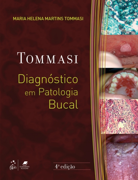 Cover image for book Diagnóstico em Patologia Bucal